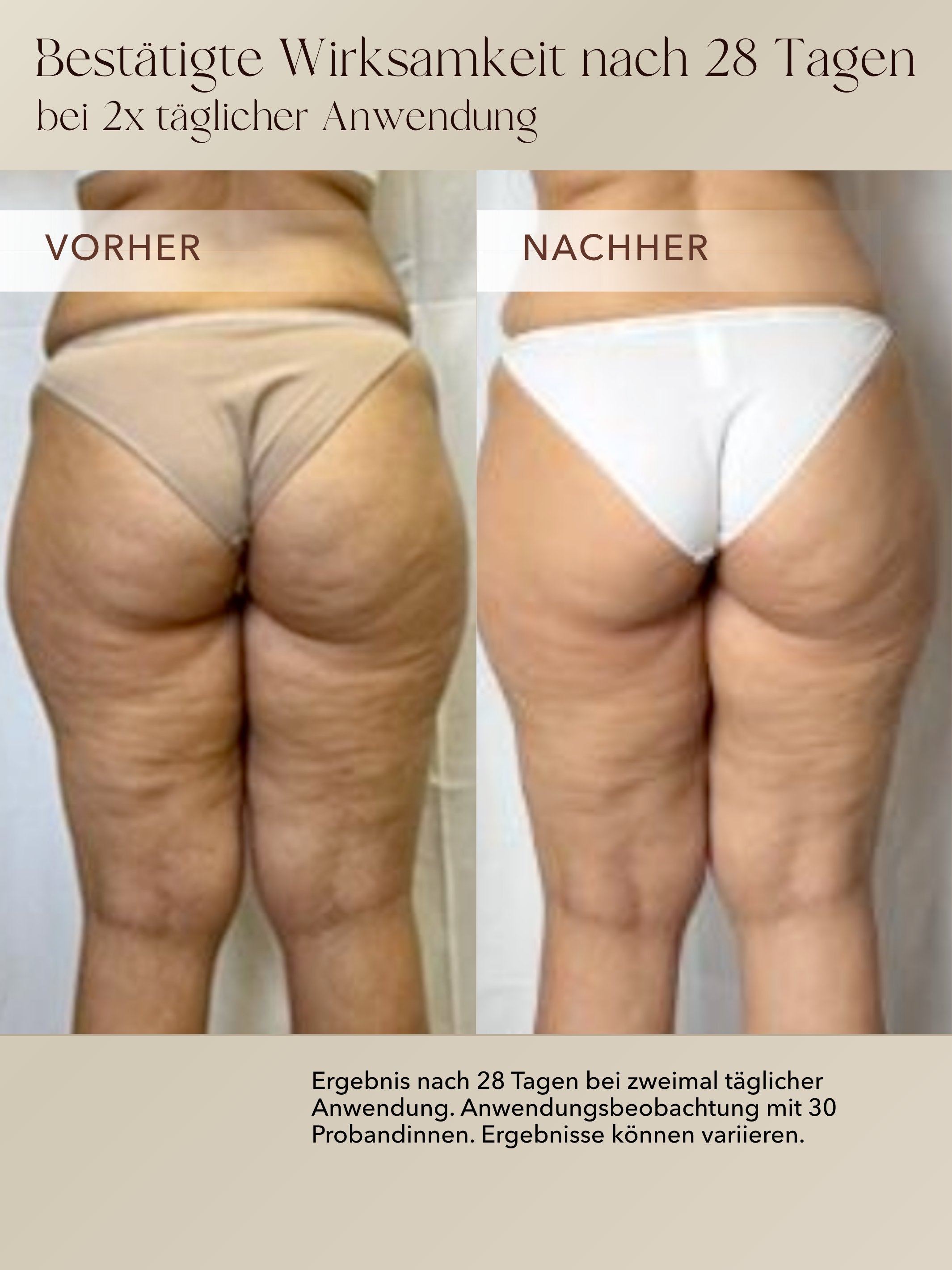 Anti-Cellulite 3-Monats-Kur