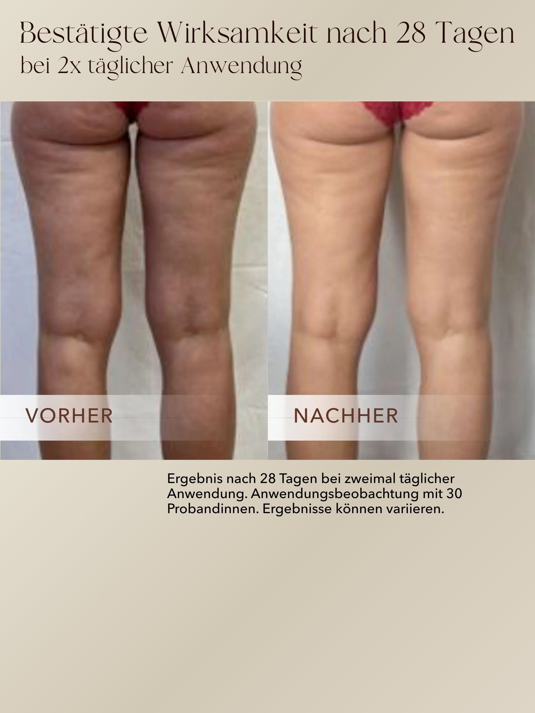 Anti-Cellulite 3-Monats-Kur