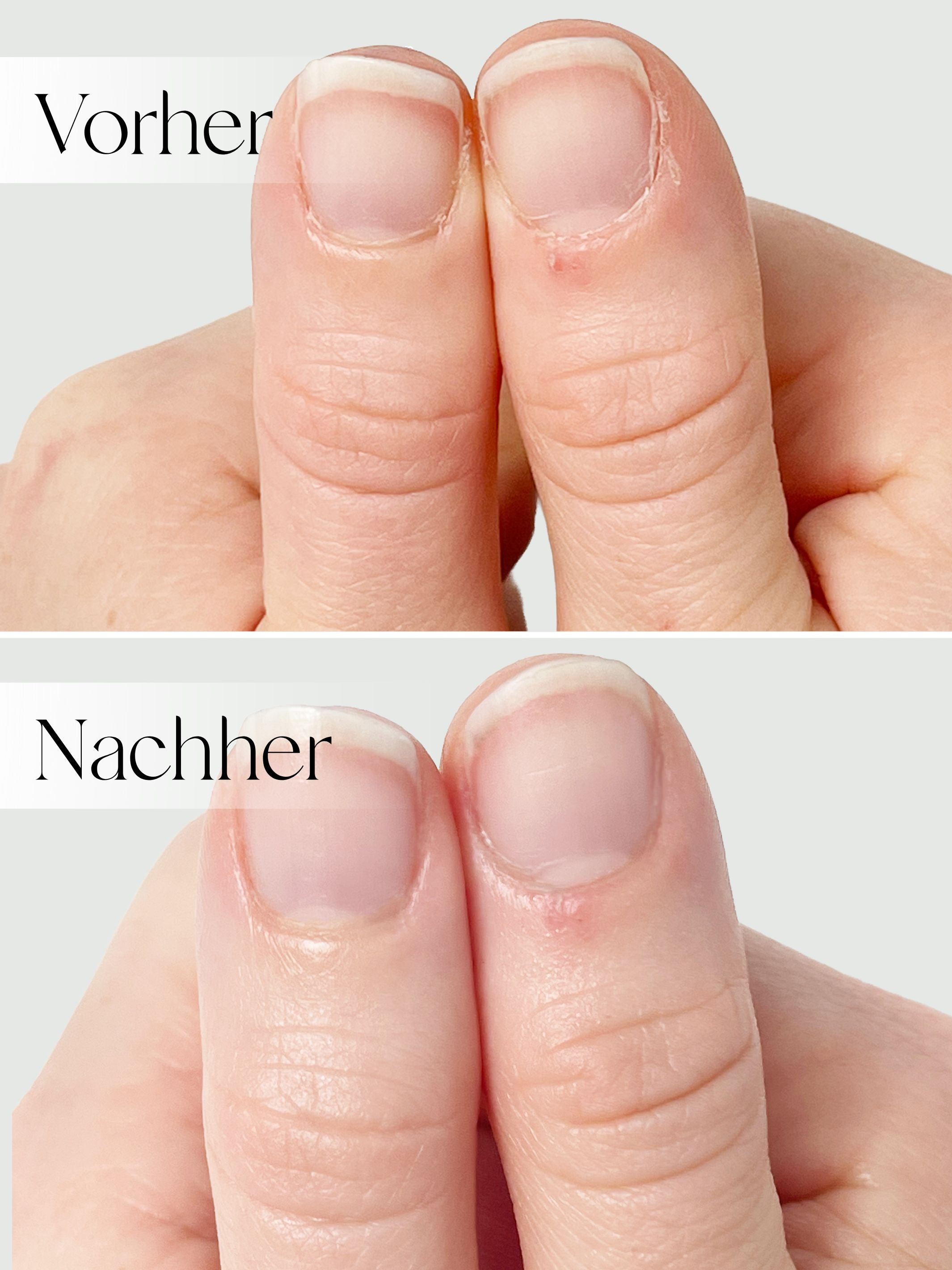 Hand &amp; Nail Cream