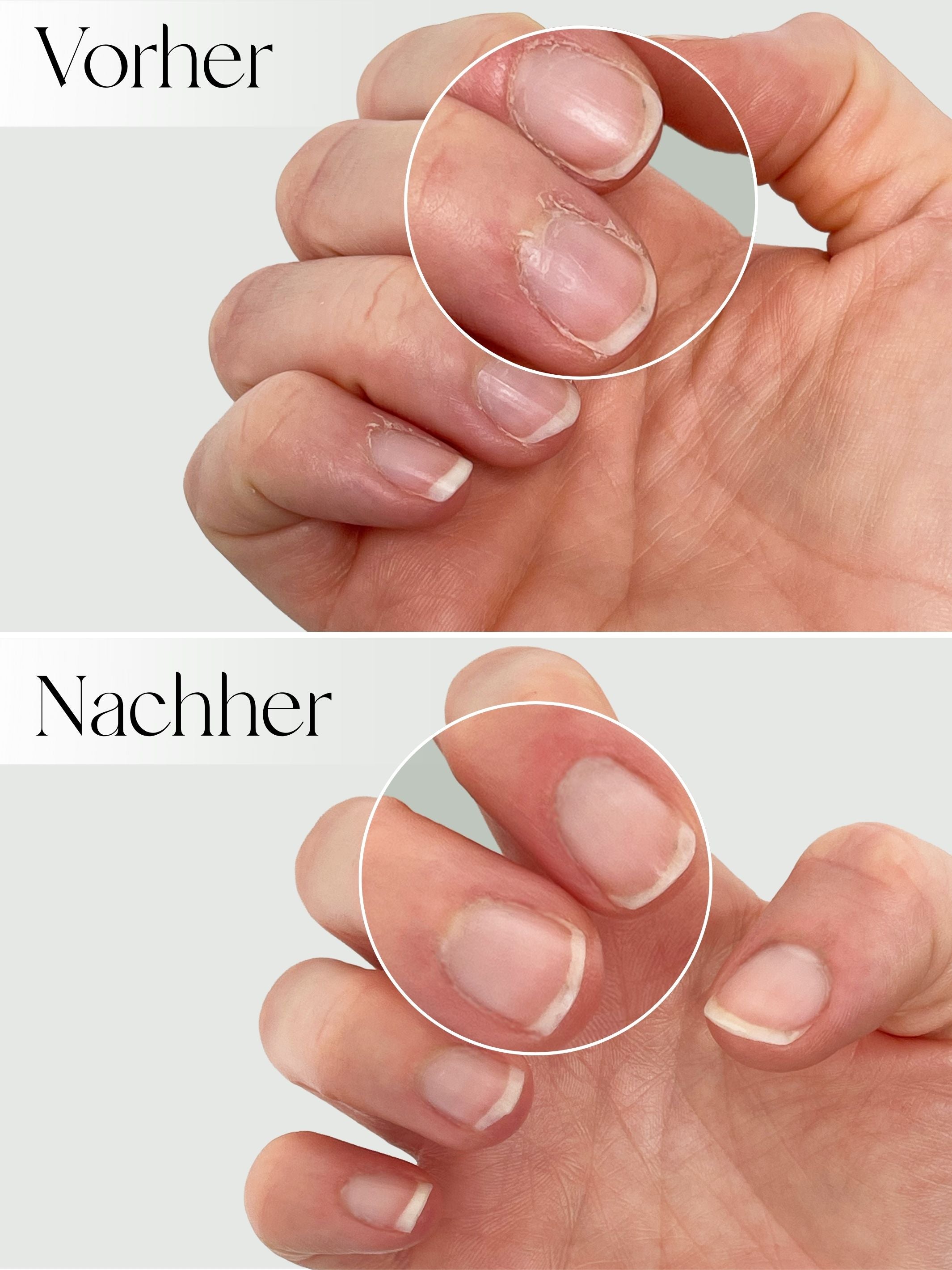 Hand &amp; Nail Cream