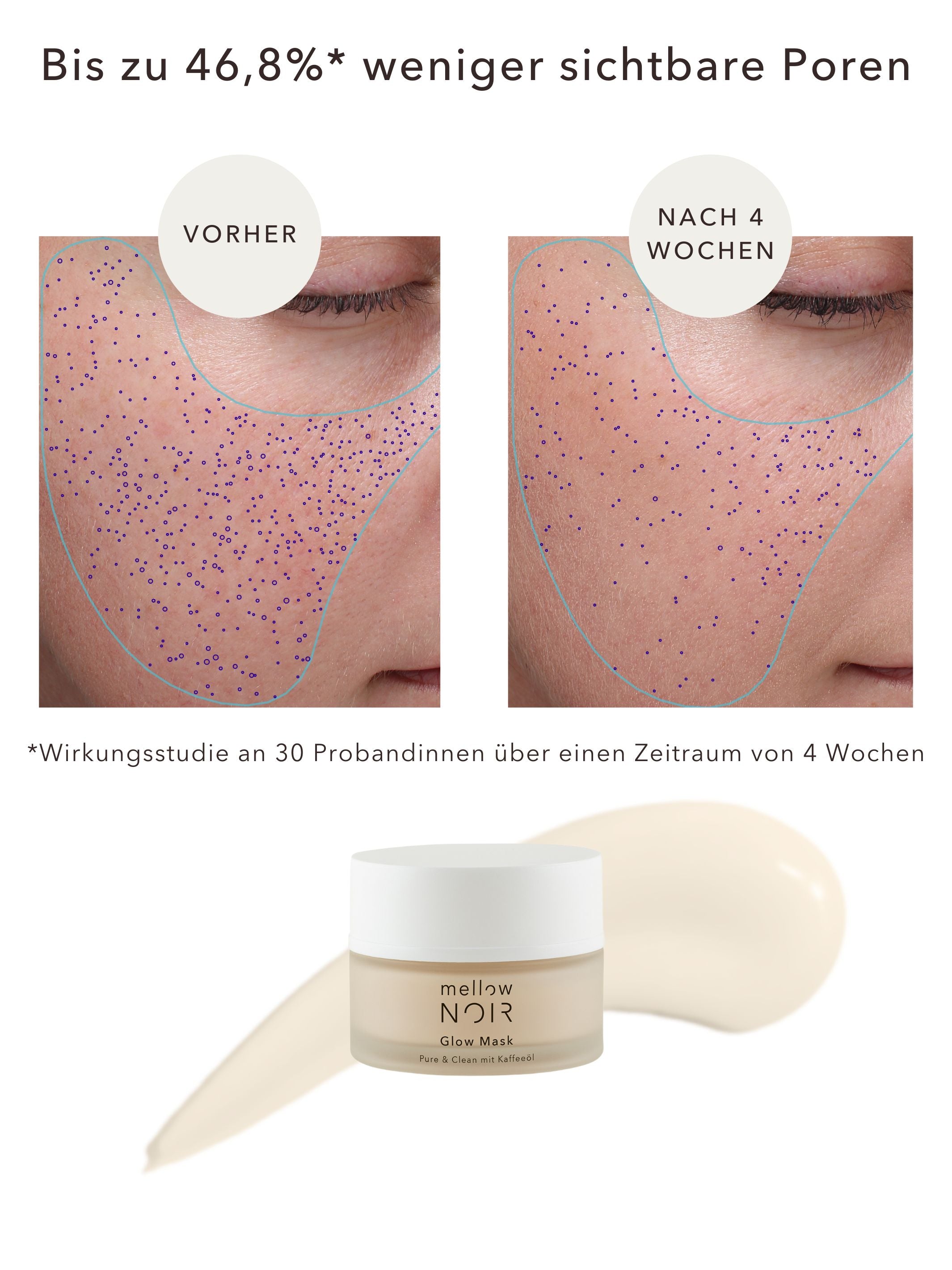Anti-grote poriën nachtverzorging